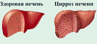 Купить справку о гепатите b c в Москве Купить справку о гепатите b c в Москве